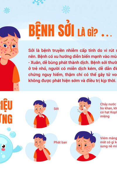 Bệnh sởi là gì ?