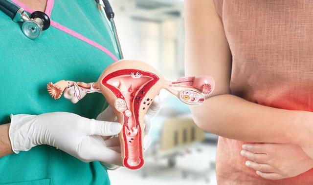 Theo khuyến cáo của Bộ Y tế, phụ nữ cần tiêm đủ 3 mũi vắc xin ngừa HPV trong vòng 6 tháng đến 1 năm.