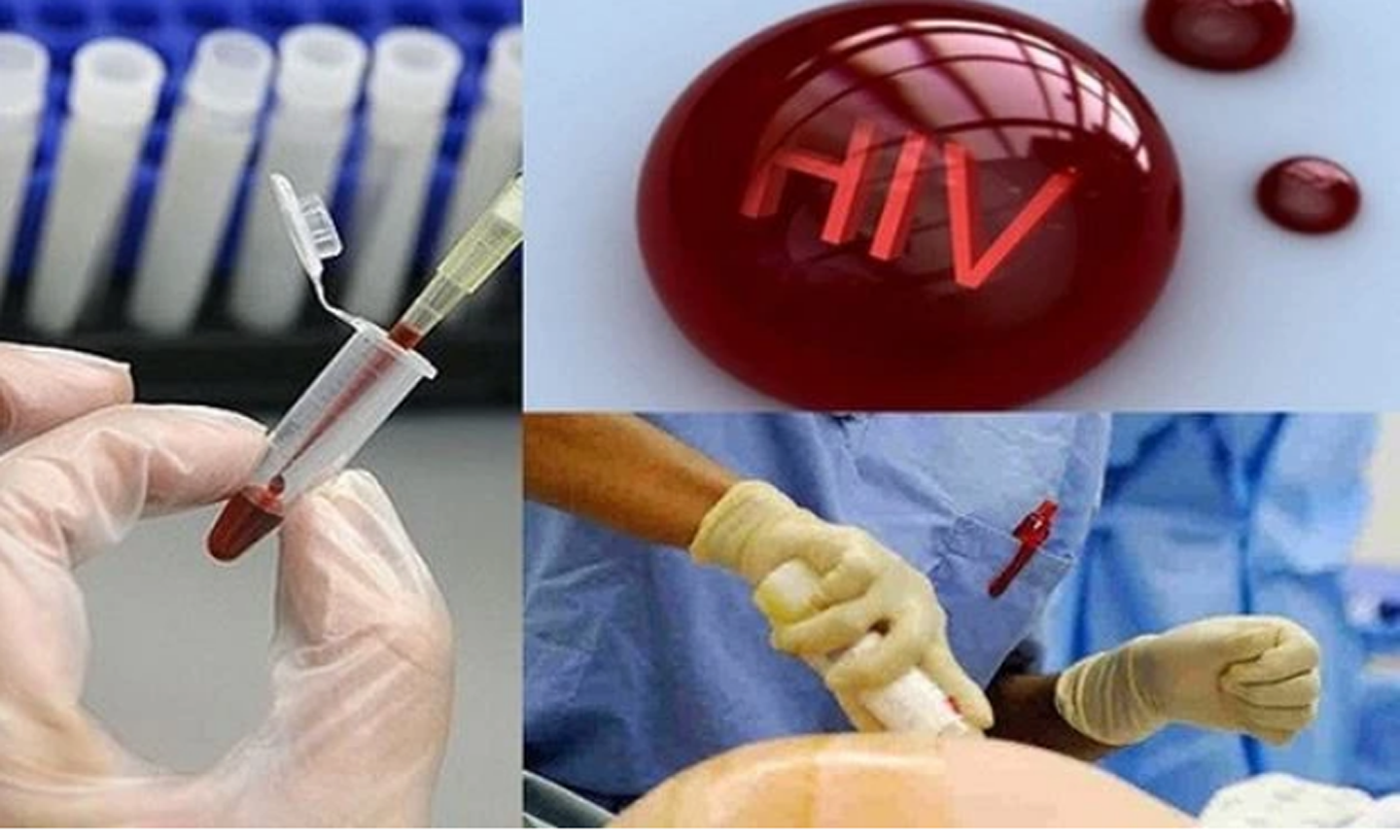 Điều kiện xác định người bị phơi nhiễm HIV, người bị nhiễm HIV do tai nạn rủi ro nghề nghiệp. (Ảnh: chinhphu.vn)
